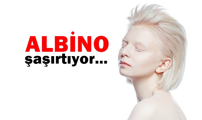 albino nedir